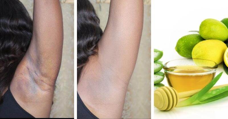 How To Get Rid Of Dark Underarms With Toothpaste How To Get Rid Of Dark Underarms: 6 Natural Remedies (With Detailed Steps)