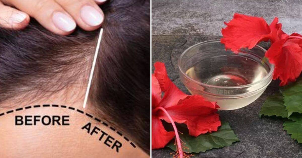 DIY These 4 Cheap Hair Oils To Solve Different Hair Problems