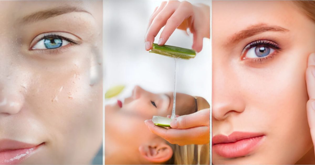 Homemade Aloe Vera Face Moisturizer For Oily Skin