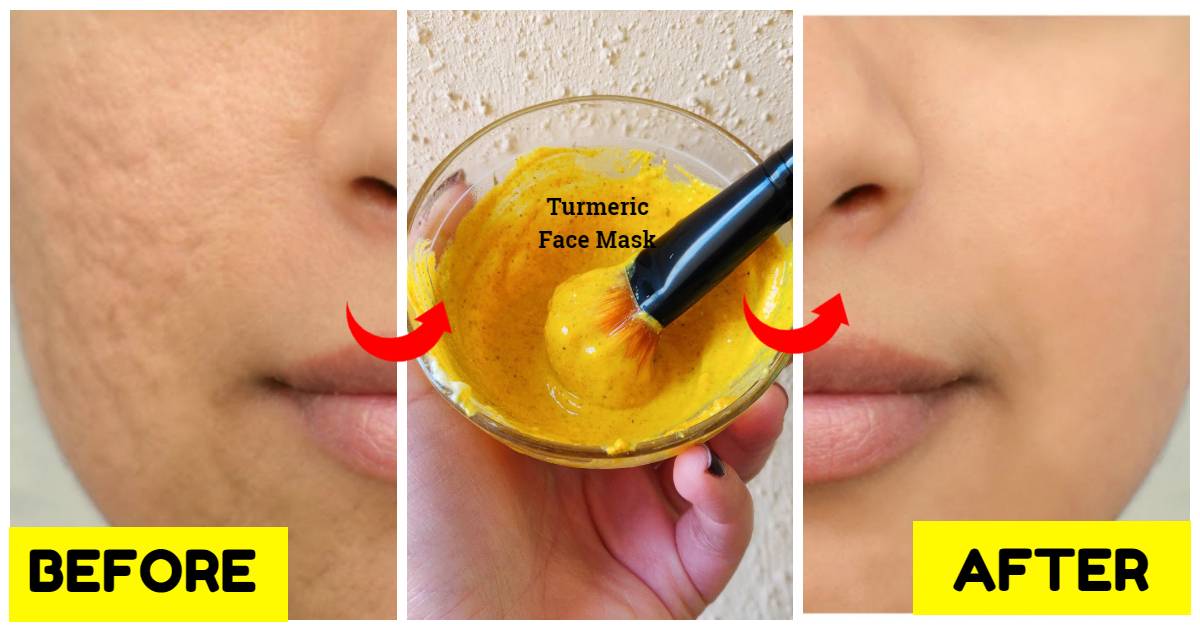 10 Effective DIY Face Masks To Deal With Open Pores