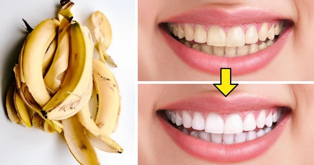 Don’t Toss Banana Peels If You Don’t Know How They Can Boost Your Wellness - Banana Peel Health Effects
