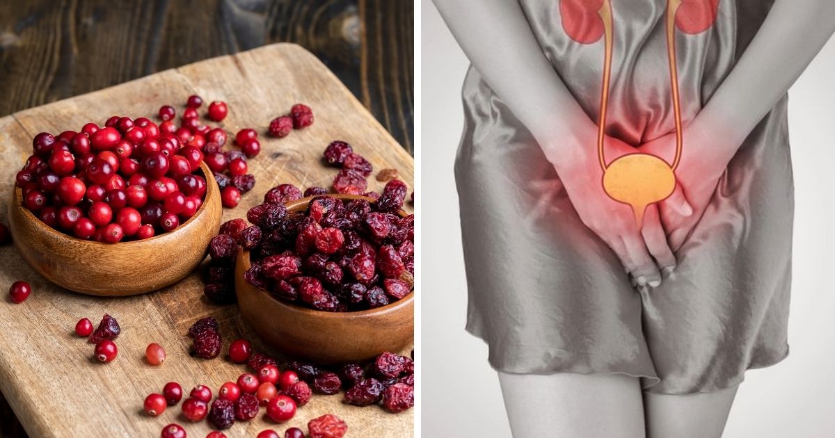 Picture of Why Are Doctors Recommending Cranberries for Urinary Tract Health?
