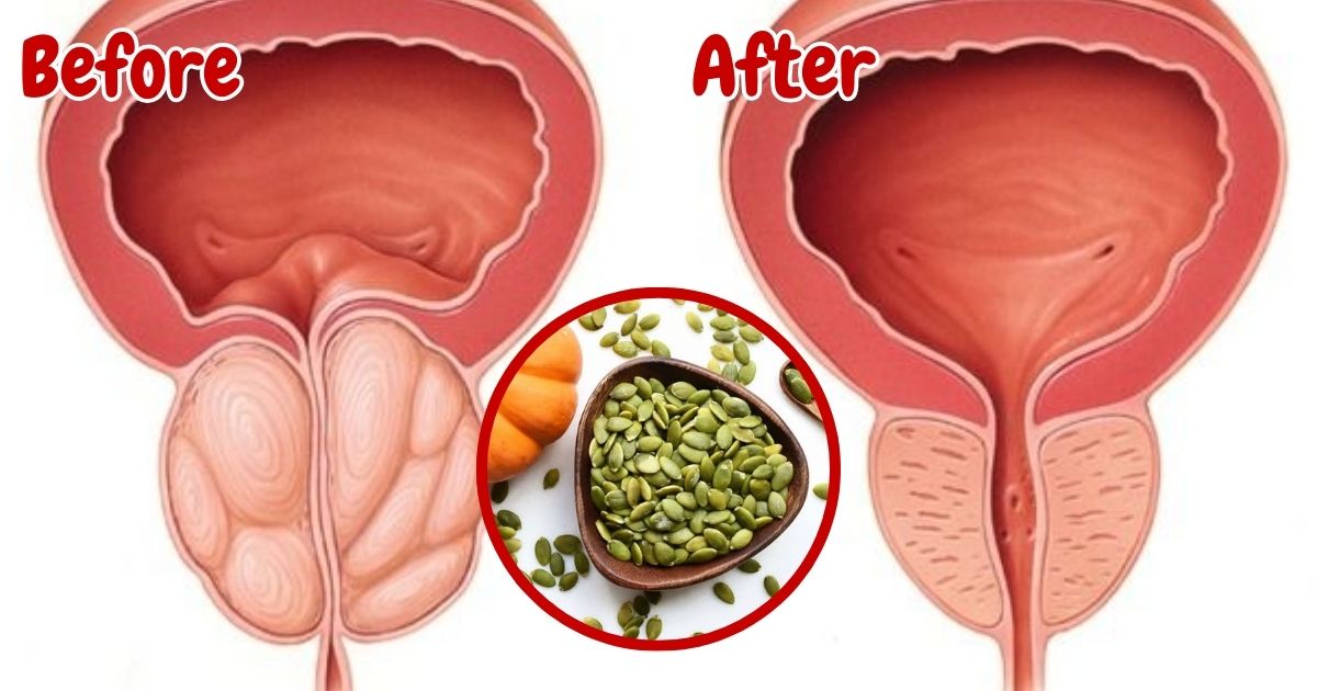Pumpkin Seeds For Prostate