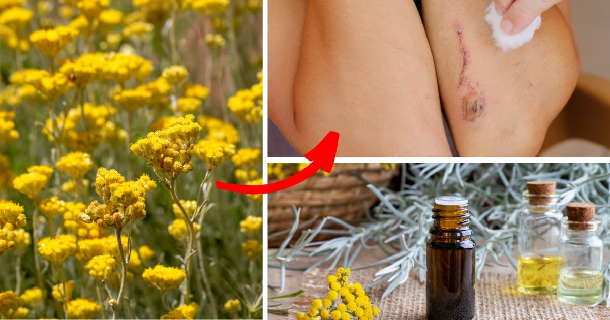 The Healing Magic of Helichrysum: 7 Amazing Health Benefits You Need to ...