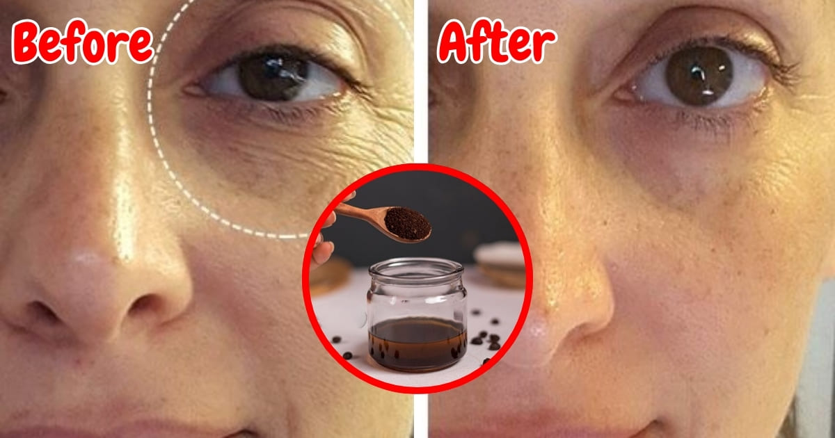 Botox! Coffee Oil is the Natural AntiAging Miracle You Need